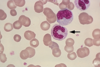   -Identify the cell at the end of the pointer. A)  Band neutrophil B)  Metamyelocyte C)  Promyelocyte D)  Monocyte