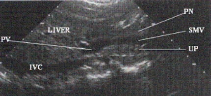 Describe the orientation of the major structures in this sagittal scanning plane image just to the right of the midline of the body.     a. ________ section of the IVC b. ________ section of the PN c. ________ section of the SMV d. ________ section of the UP e. ________ section of the LIVER