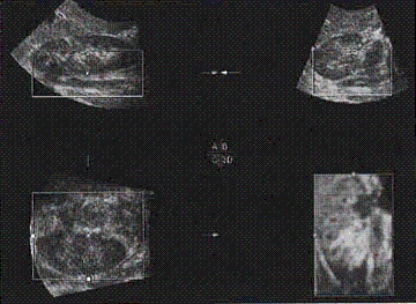 The main anatomy shown on this image is a(n) __________.   
