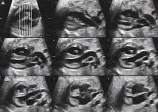 The main anatomy shown on this image is the __________.   