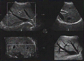 The mode used for this image of the liver is the __________.   