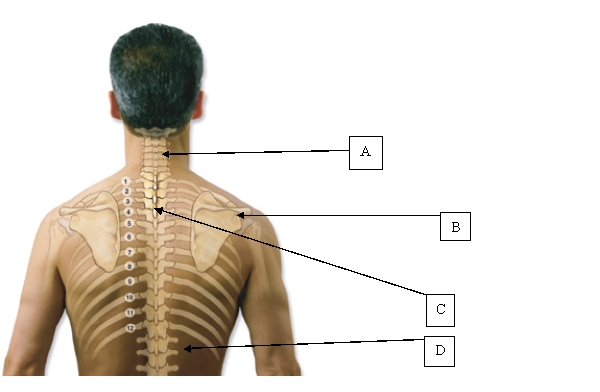 <strong>The nurse is performing a physical assessment of the client. Which is the location for the costovertebral angle? </strong> A) A. B) B. C) C. D) D.