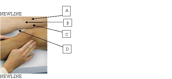The nurse is performing the bulge test on a client's left knee. Which area will the nurse assess for bulging during this test?   A)  A. B)  B. C)  C. D)  D.