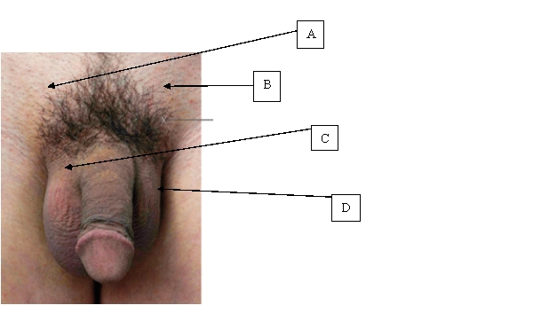 The nurse is preparing to assess a male client who states,  I think I have a hernia in my right groin.  During the physical examination, which area will the nurse palpate to assess for an inguinal hernia?   A)  A. B)  B. C)  C. D)  D.
