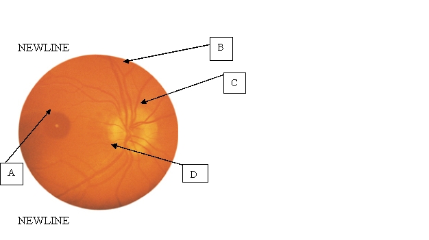 The nurse is assessing the client's retina. Where is the optic disc located?   A)  A. B)  B. C)  C. D)  D.
