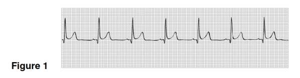 The mean rate in Figure 1 is   A) 50. B) 60. C) 70. D) 100.