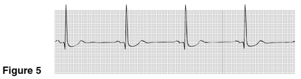 In Figure 5,the heart rate is closest to   A) 100. B) 40. C) 75. D) 55.