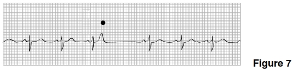 The rhythm in Figure 7 is   A) Sinus rhythm with a sinus arrest and a junctional escape beat. B) Sinus arrhythmia. C) Sinus rhythm with a nonconducted PAC. D) Wandering atrial pacemaker.