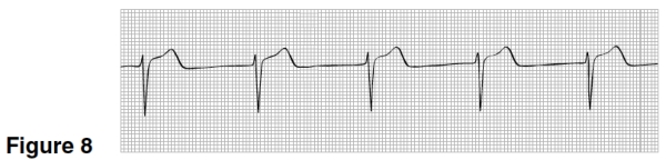 The heart rate in Figure 8 is closest to   A) 50. B) 75. C) 100. D) 125.