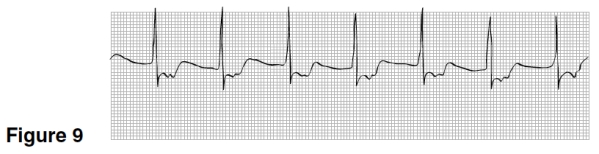 In Figure 9,the P waves are   A) Upright,rounded,preceding the QRS. B) Inverted preceding the QRS. C) Not visible. D) Inverted following the QRS.