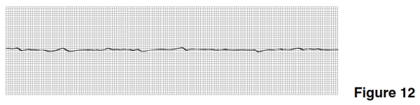 In Figure 12,there are only   A) P waves. B) QRS complexes. C) T waves. D) U waves.