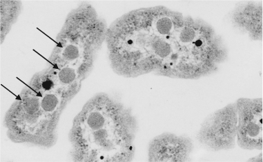 The structures marked with arrows in the photo below are ________ and are used to ________.   A)  polyhydroxyalkanoates; sequester reactions using bicarbonate or carbon dioxide and Rubisco B)  polyhydroxyalkanoates; store carbon for energy C)  carboxysomes; store carbon for energy D)  carboxysomes; sequester reactions using bicarbonate or carbon dioxide and Rubisco E)  heterocysts; sequester reactions using bicarbonate or carbon dioxide and Rubisco