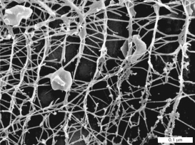 Pyrodictium species grow as networks interconnected by glycoprotein tubules called   A)  cannulae. B)  pili. C)  fimbriae. D)  flagella. E)  actin filaments.