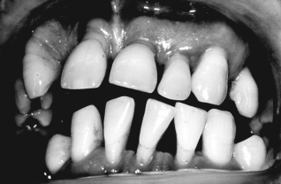 Describe what is happening in the figure below.  <div style=padding-top: 35px> 