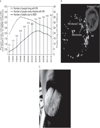 Using the following figures, interpret what is occurring in Figure C.  <div style=padding-top: 35px> 