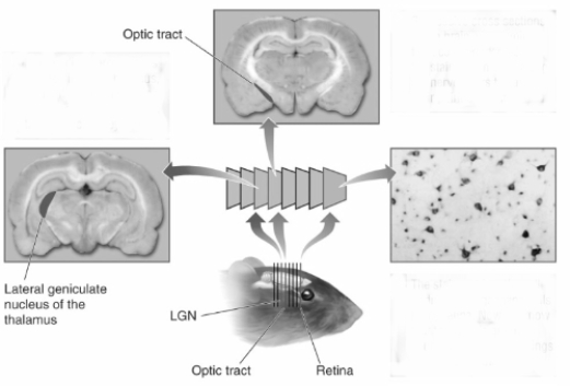   In the procedure illustrated here,stain is first injected into the ___________________________________,and then it travels to cell bodies located in the ____________________.