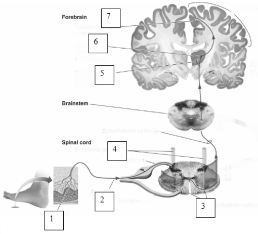   Pain information travels through the spinal cord to the brain along the pathway labeled  3  in this image.What is the name of this pathway? A)  the reticulospinal tract B)  the rubrospinal tract C)  the spinothalamic pathway D)  the corticospinal tract