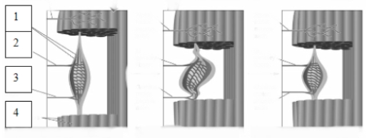   The structure indicated by the number 2 in this image is known as a(n)  A)  extrafusal fiber. B)  Ia sensory fiber. C)  gamma motor fiber. D)  intrafusal fiber.