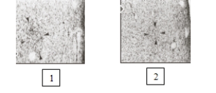   These samples obtained by Simon Levay indicate differences between heterosexual males and homosexual males in A)  SDN-POA. B)  INAH-3. C)  the SNB. D)  the thalamus.