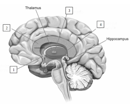   The structures in this illustration were severed in the classic split brain procedures used by Joseph Bogen.They are number 1,____________________,number 2,____________________,number 3,____________________,and number 4,____________________.