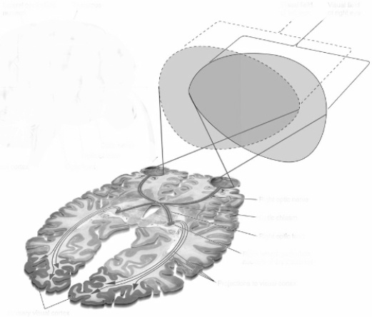 (see Figure 6.16) ​    -The primary visual,or striate,cortex is located in the _________ lobe.​  A) frontal  B) parietal  C) temporal  D) occipital