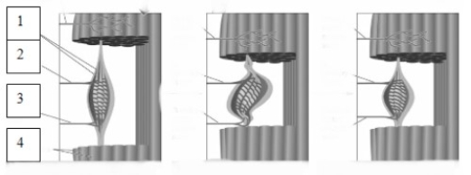   -The structure indicated by the number 2 in this image is known as a(n) ​  A) extrafusal fiber.  B) Ia sensory fiber.  C) gamma motor fiber.  D) intrafusal fiber.
