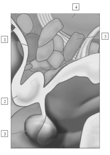 (see Figure 9.6)     -The structure labeled  1  in this illustration is the​  A) posterior hypothalamus  B) thalamus  C) pituitary gland  D) preoptic area of the hypothalamus