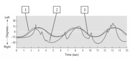 see Figure 16.7    -Describe the significance of these tracings to our understanding of the genetic basis of schizophrenia.
