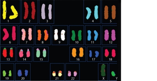 Figure 12.1   -What can you infer from the karyotype shown in Figure 12.1? A) There is a translocation in one of the chromosome 8 homologues. B) This individual has a single sex chromosome. C) This individual has an abnormal number of autosomes. D) This is a karyotype of a male.