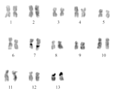 Figure 12.2   -The karyotype shown above is that of a snail,Pomacea patula catemacensis.What is the diploid number for this organism? A) 13 B) 26 C) 46 D) 7