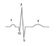 <strong>Figure 44.1 On the ECG above,which waveform represents electrical activity within the atria?</strong> A)1 B)2 C)3