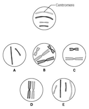 Use the following information to answer the question(s)  below. The unlettered circle at the top of the accompanying figure shows a diploid nucleus with four chromosomes that have not yet replicated. There are two pairs of homologous chromosomes, one long and the other short. One haploid set is black, and the other is gray. The circles labeled A to E show various combinations of these chromosomes.   -What is the correct chromosomal condition at prometaphase of mitosis? A)  A B)  B C)  C D)  D E)  E