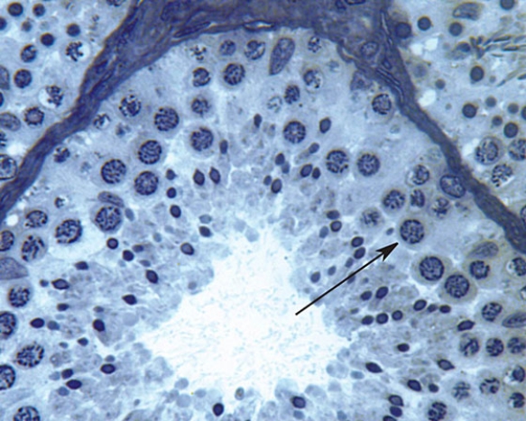Identify the cell at the tip of the arrow   A)  spermatogonia A B)  spermatogonia B C)  primary spermatocyte D)  secondary spermatocyte E)  spermatid
