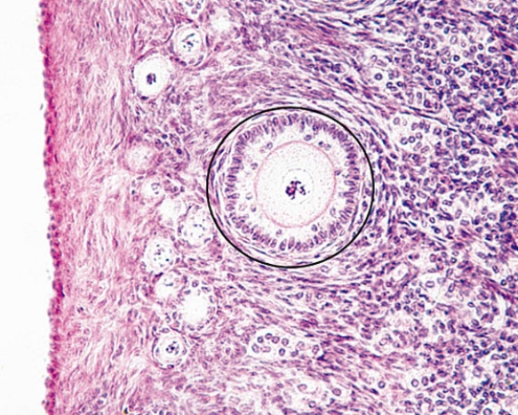 The structure enclosed in the circle is a(n)    A)  primordial follicle B)  unilaminar primary follicle C)  multilaminar primary follicle D)  secondary follicle E)  mature follicle
