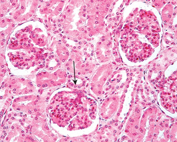 The structure at the tip of the arrow   A)  releases renin B)  releases angiotensin I C)  is a proximal convoluted tubule D)  adjoins the afferent glomerular arteriole E)  is located at the urinary pole of the renal corpuscle