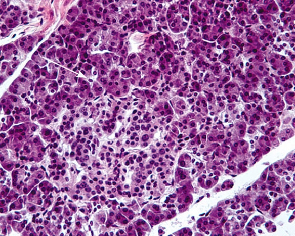 The tip of the white arrow is pointing to which of the following?   A)  acinar cell B)  beta cell C)  alpha cell D)  centroacinar cell E)  delta cell