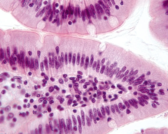 In Fig. Img_005a, a patient presents with an ulcer.This photomicrograph shows a healthy area of the ulcerated organ. Where is this patient's ulcer located?   A)  esophagus B)  fundic stomach C)  pyloric stomach D)  duodenum E)  jejunum