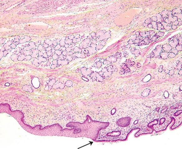 The tip of the arrow indicates the junction of the   A)  rectum and the anus B)  rectum and the colon C)  stomach and the duodenum D)  stomach and the esophagus E)  esophagus and the pharynx