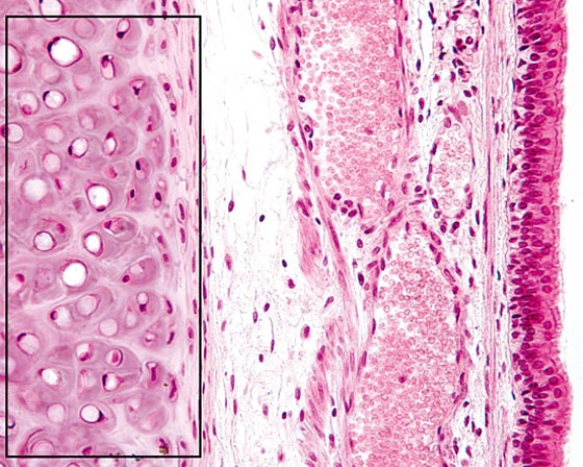 Identify the structure enclosed in the rectangle   A)  elastic cartilage of the epiglottis B)  fibrocartilage of the intervertebral disk C)  cartilage plate of a secondary bronchus D)  C ring of the trachea E)  epiphyseal plate of a growing bone