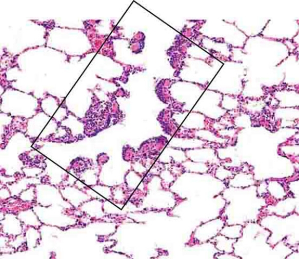 The region enclosed by the rectangle is a (an)    A)  bronchiole B)  terminal bronchiole C)  respiratory bronchiole D)  alveolar duct E)  alveolar sac