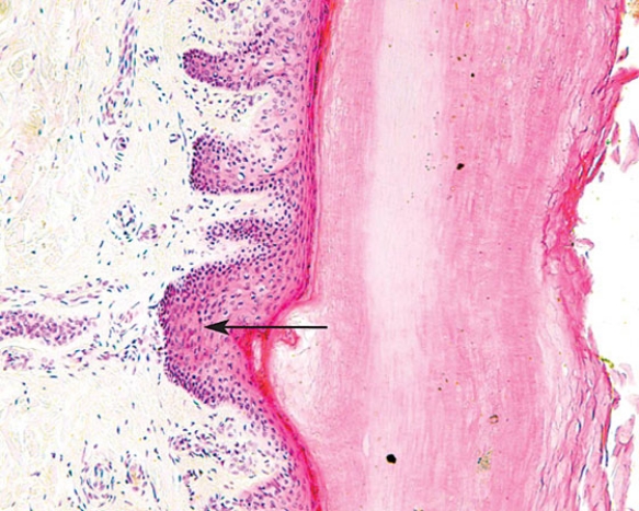 Identify the layer at the arrow tip   A)  stratum basale B)  stratum spinosum C)  stratum granulosum D)  stratum lucidum E)  stratum corneum