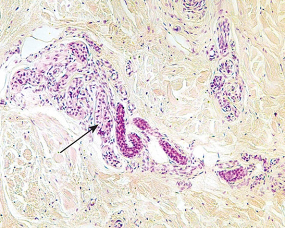 The structure at the tip of the arrow   A)  is a mechanoreceptor B)  manufactures sebum C)  manufactures a mucous secretion D)  manufactures sweat E)  is the duct of a sweat gland