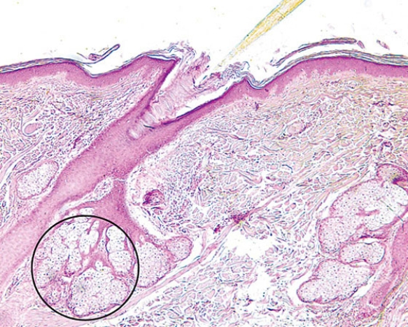 The encircled structure   A)  is a mechanoreceptor B)  manufactures sebum C)  manufactures a mucous secretion D)  manufactures sweat E)  is the duct of a sweat gland