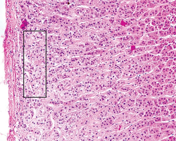 The region of the organ enclosed by the rectangle produces   A)  androgens B)  aldosterone C)  melatonin D)  adrenocorticotropic hormone (ACTH)  E)  angiotensin II