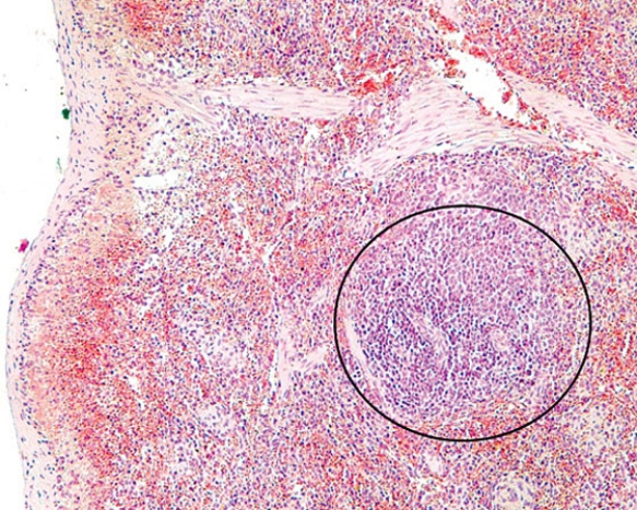 The region inside the circle is the   A)  cortex of a lymph node B)  medulla of a lymph node C)  cortex of the thymus D)  medulla of the thymus E)  white pulp of the spleen