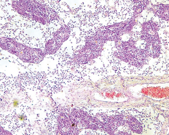 This photomicrograph represents the   A)  cortex of a lymph node B)  medulla of a lymph node C)  cortex of the thymus D)  medulla of the thymus E)  white pulp of the spleen