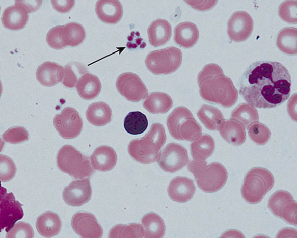  The structures at the tip of the arrow   A)  arise from CFU-GM B)  arise from reticulocytes C)  house major dense protein D)  house  \alpha -granules E)  release von Willebrand factor 
