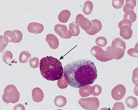 The cell at the tip of the arrow is a(n)    A)  basophilic metamyelocyte B)  basophilic myelocyte C)  neutrophilic myelocyte D)  eosinophilic metamyelocyte E)  eosinophilic myelocyte