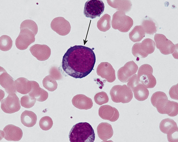 The cell at the tip of the arrow is a   A)  basophilic erythroblast B)  myeloblast C)  proerythroblast D)  promyelocyte E)  polychromatophilic erythroblast