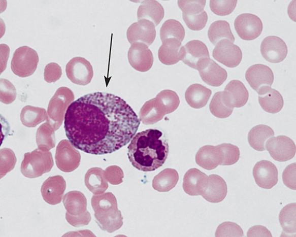 The cell at the arrow tip is a   A)  basophilic erythroblast B)  myeloblast C)  proerythroblast D)  promyelocyte E)  polychromatophilic erythroblast